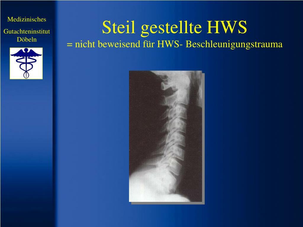 PPT - Beschleunigungstrauma Der Halswirbelsäule PowerPoint Presentation ...