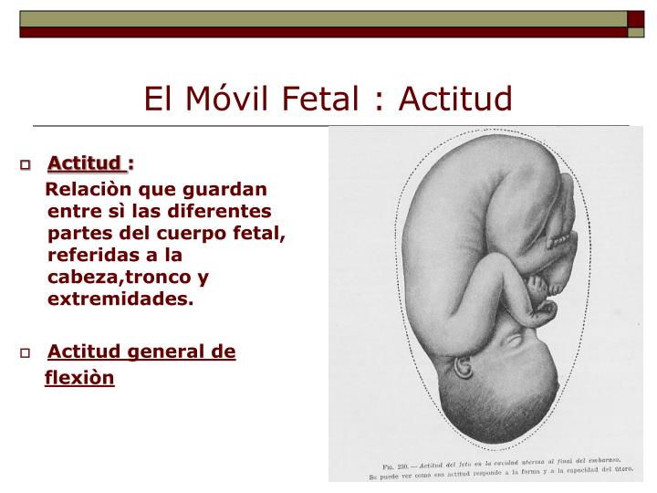mitral valve tenting area