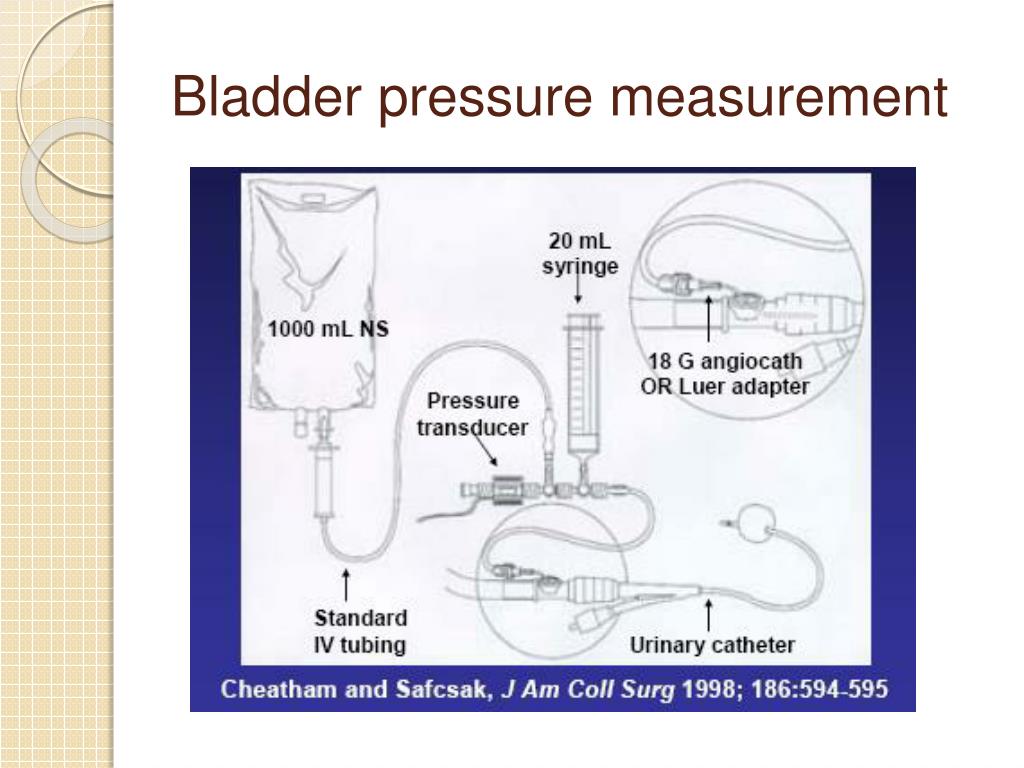 PPT Abdominal Compartment Syndrome in Trauma PowerPoint Presentation PPT Abdominal Compartment Syndrome in Trauma PowerPoint Presentation
