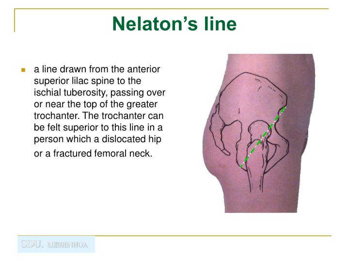 PPT - Regional anatomy of the lower limb PowerPoint Presentation - ID ...