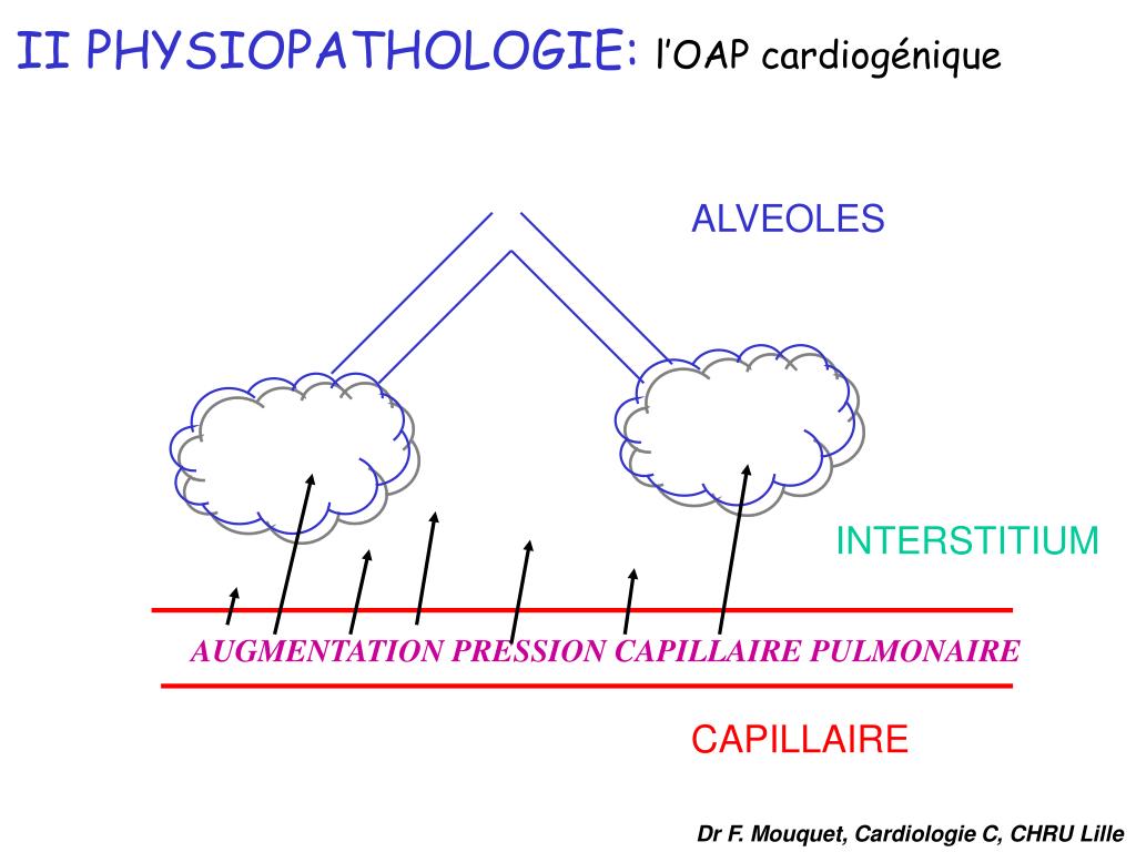 PPT - OEDEME AIGU PULMONAIRE (OAP) PowerPoint Presentation, free download -  ID:900285
