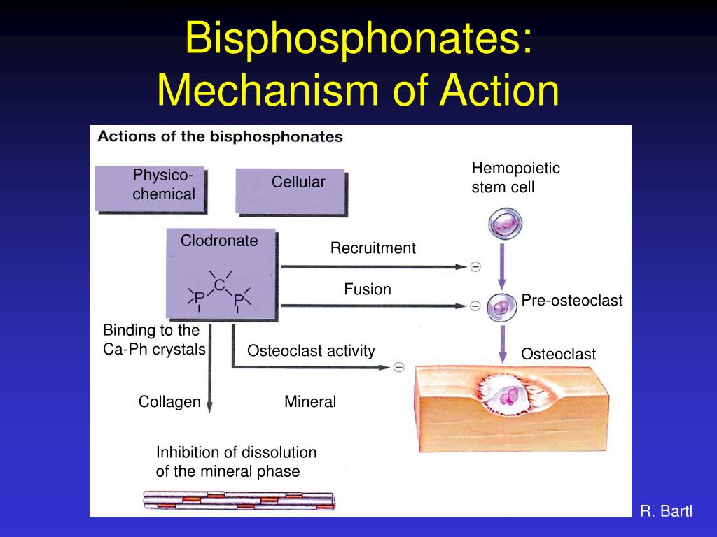 Bisphosphonate gelenkschmerzen