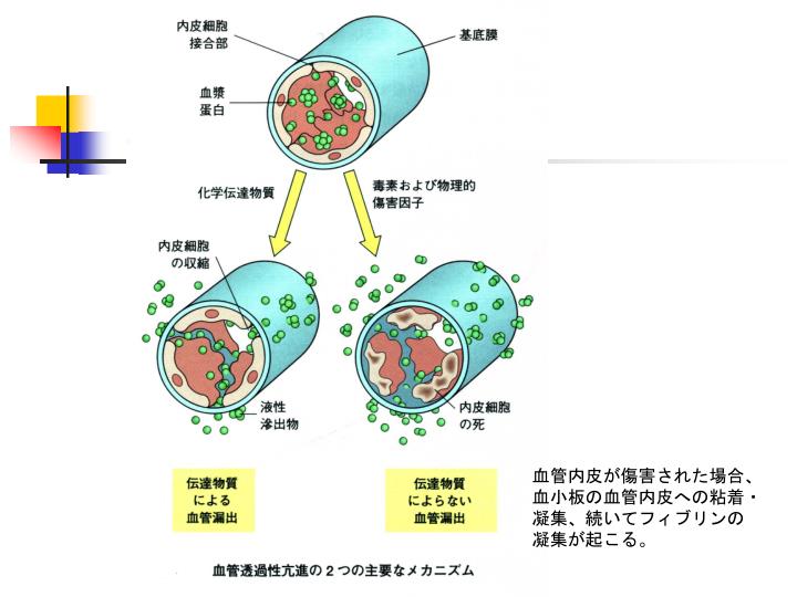 PPT - Inflammation 炎症 PowerPoint Presentation - ID:911706