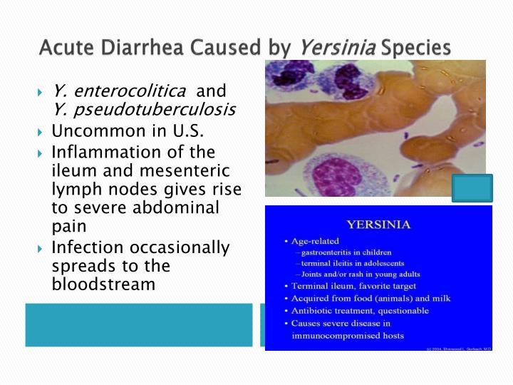 acute gastroenteritis About gastroenteritis: an acute inflammation of the lining of the stomach and intestines, characterised by anorexia, nausea, diarrhoea, abdominal pain and weakness, which has various causes, including food poisoning due to infection with such organisms as escherichia coli, staphylococcus aureus and salmonella species, consumption of. acute gastroenteritis About gastroenteritis: an acute inflammation of the lining of the stomach and intestines, characterised by anorexia, nausea, diarrhoea, abdominal pain and weakness, which has various causes, including food poisoning due to infection with such organisms as escherichia coli, staphylococcus aureus and salmonella species, consumption of.