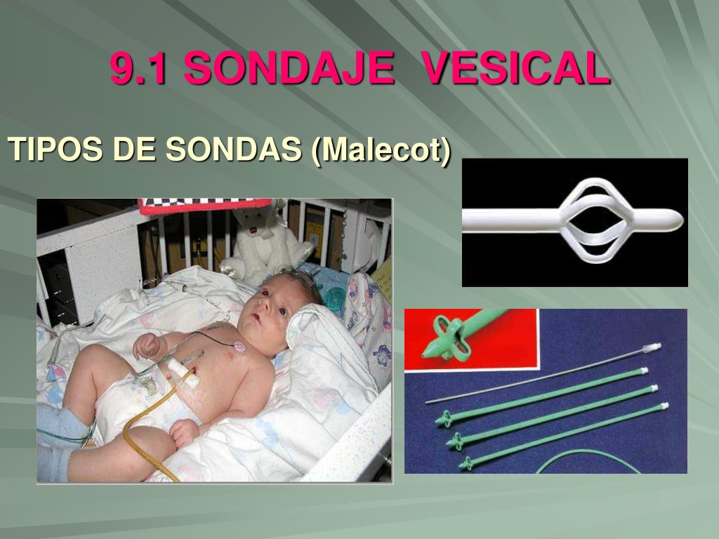 PPT - 9. SONDAS PowerPoint Presentation, free download - ID:914034