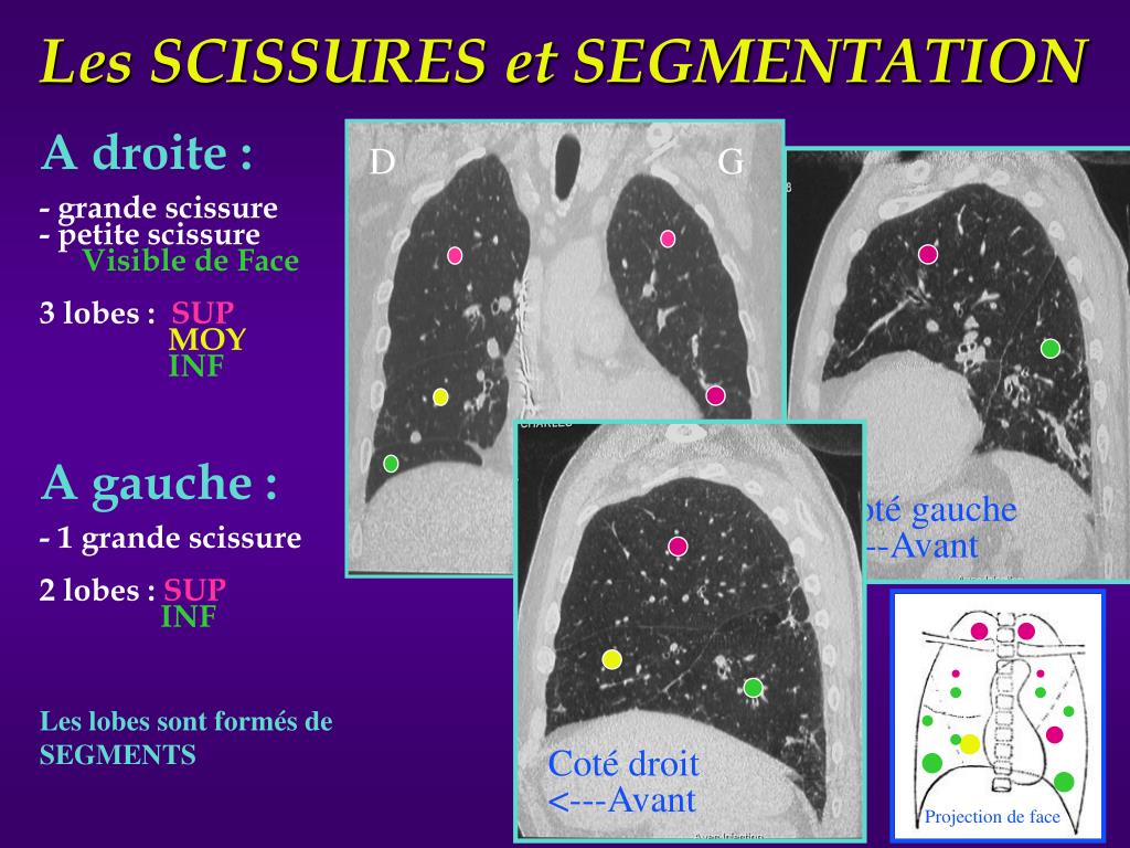 PPT EIA De Pneumologie PowerPoint Presentation Free Download ID 914372 PPT EIA De Pneumologie PowerPoint Presentation Free Download ID 914372