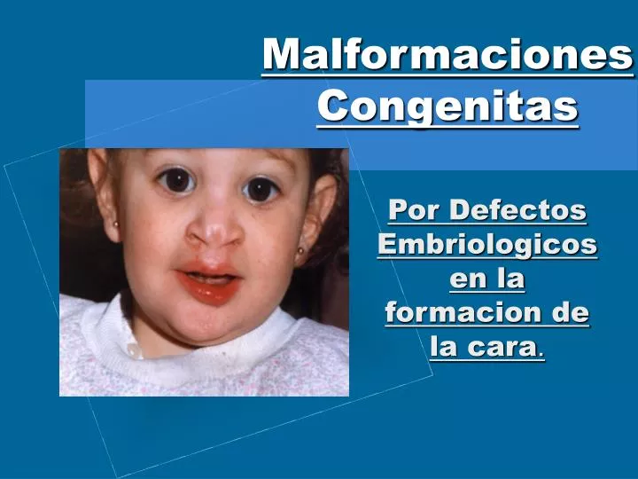 PPT - Malformaciones Congenitas PowerPoint Presentation, free download -  ID:916611