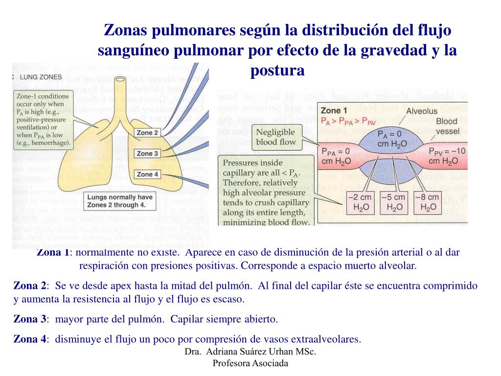 PPT Ventilaci n Y Perfusi n De Los Pulmones PowerPoint Presentation PPT Ventilaci n Y Perfusi n De Los Pulmones PowerPoint Presentation