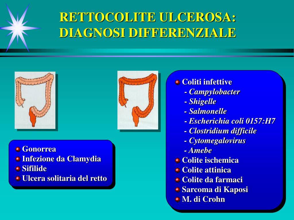 Malattia Infettiva Intestinale Cruciverba PPT - MALATTIE INFIAMMATORIE CRONICHE INTESTINALI PowerPoint