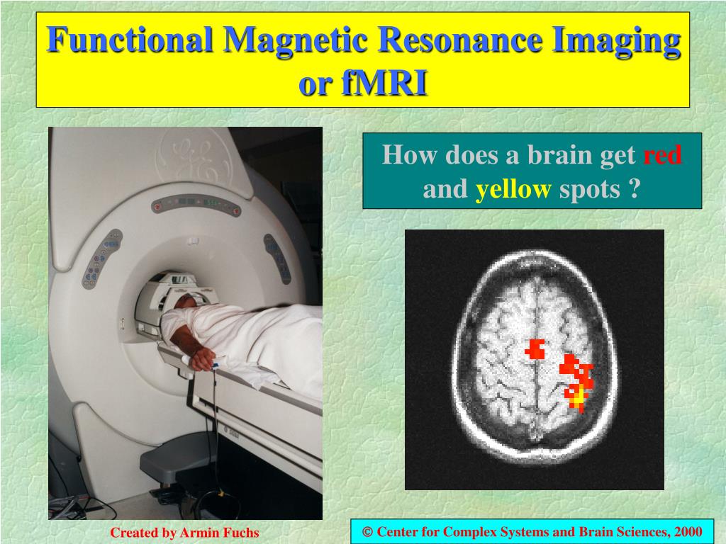 PPT - Functional Magnetic Resonance Imaging or fMRI PowerPoint Presentation - ID:92003