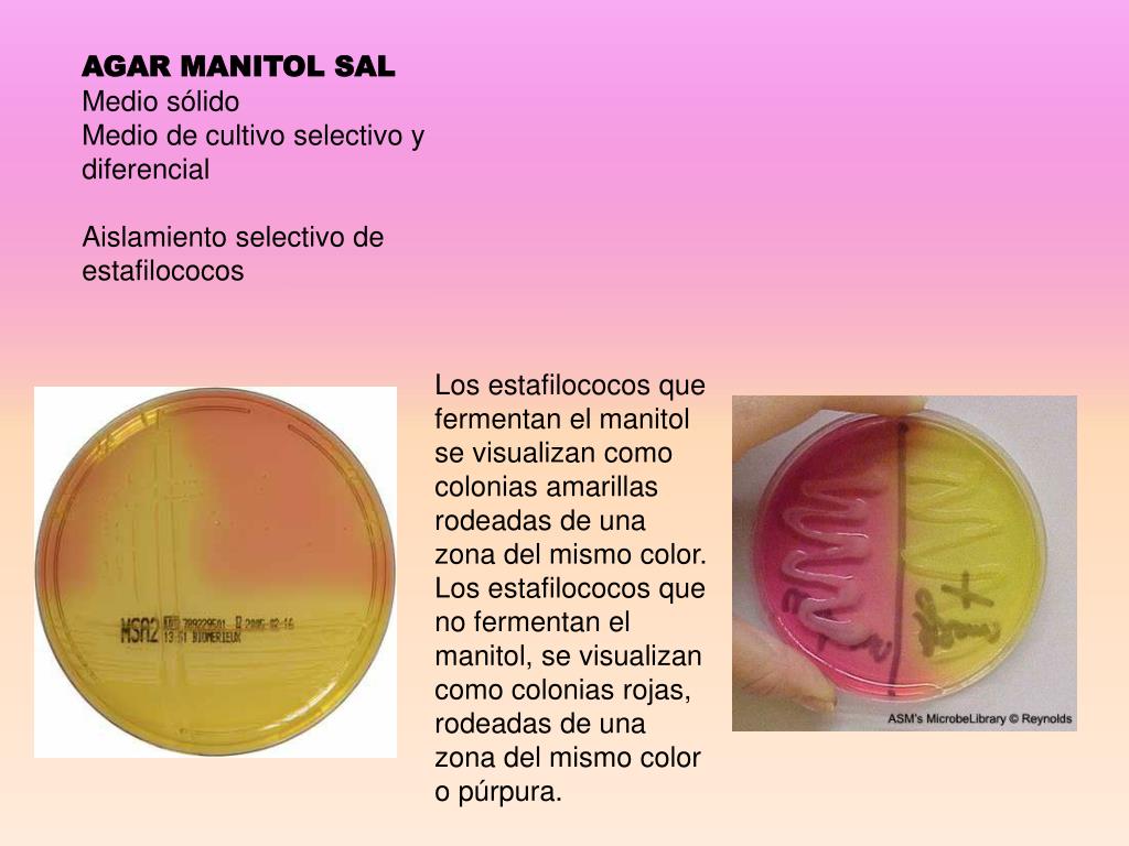 PPT AGAR MACCONKEY Medio de cultivo sólido PowerPoint Presentation