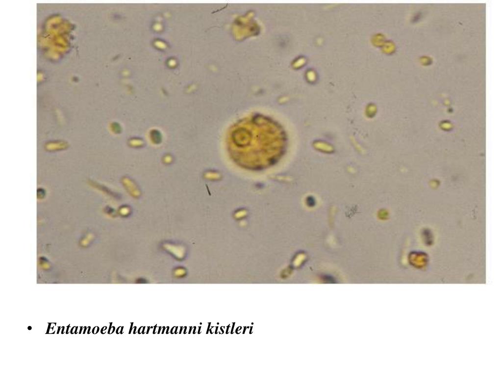 Простейшие в кале лечение. Цисты Entamoeba. Entamoeba Hartmanni цисты. Цисты лямблий микроскопия. Циста лямблии под микроскопом.