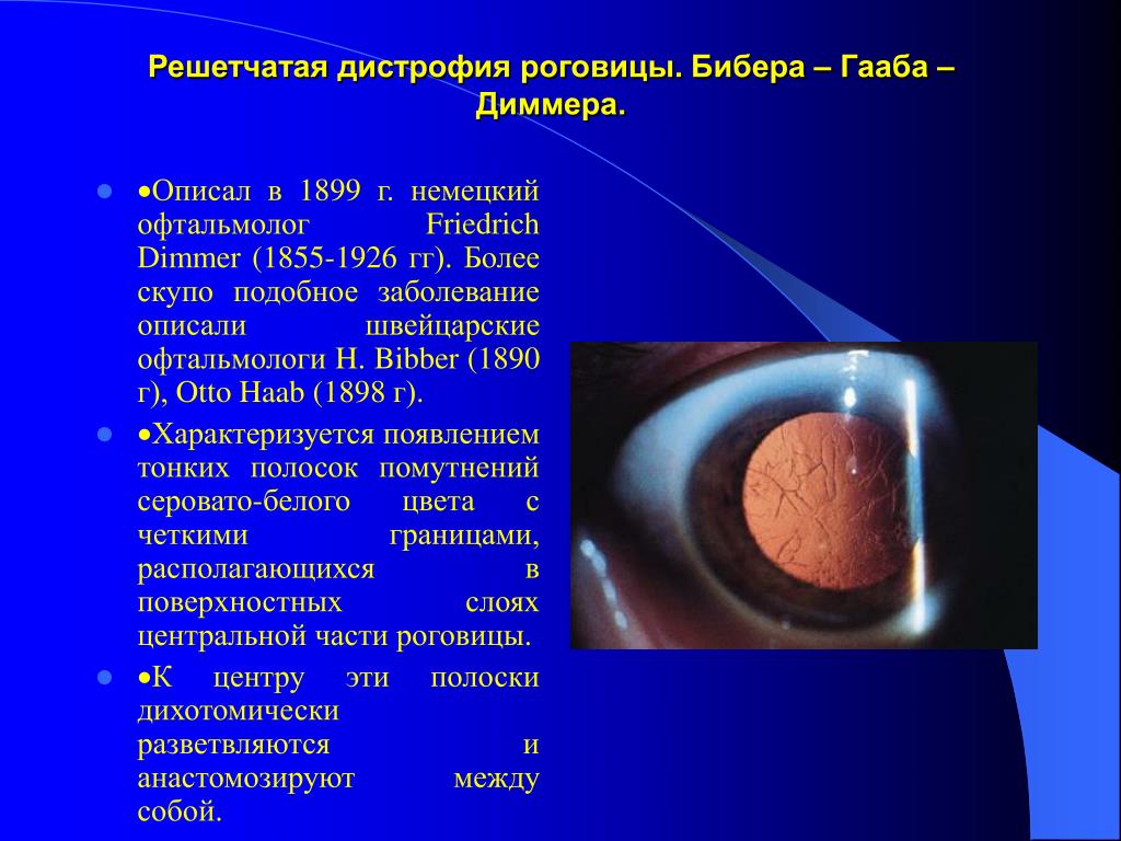 Дистрофия дегенерация. Стромальная дистрофия роговицы. Макулярная дистрофия роговицы. Эндотелиальная дистрофия роговицы. Мезодермальная дистрофия роговицы.