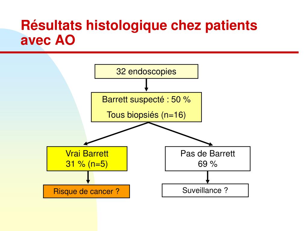 Atresie De Loesophage Esperance De Vie Atrésie De L'oesophage Esperance De Vie - Communauté MCMS