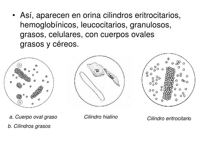 PPT - Examen de orina PowerPoint Presentation - ID:954549