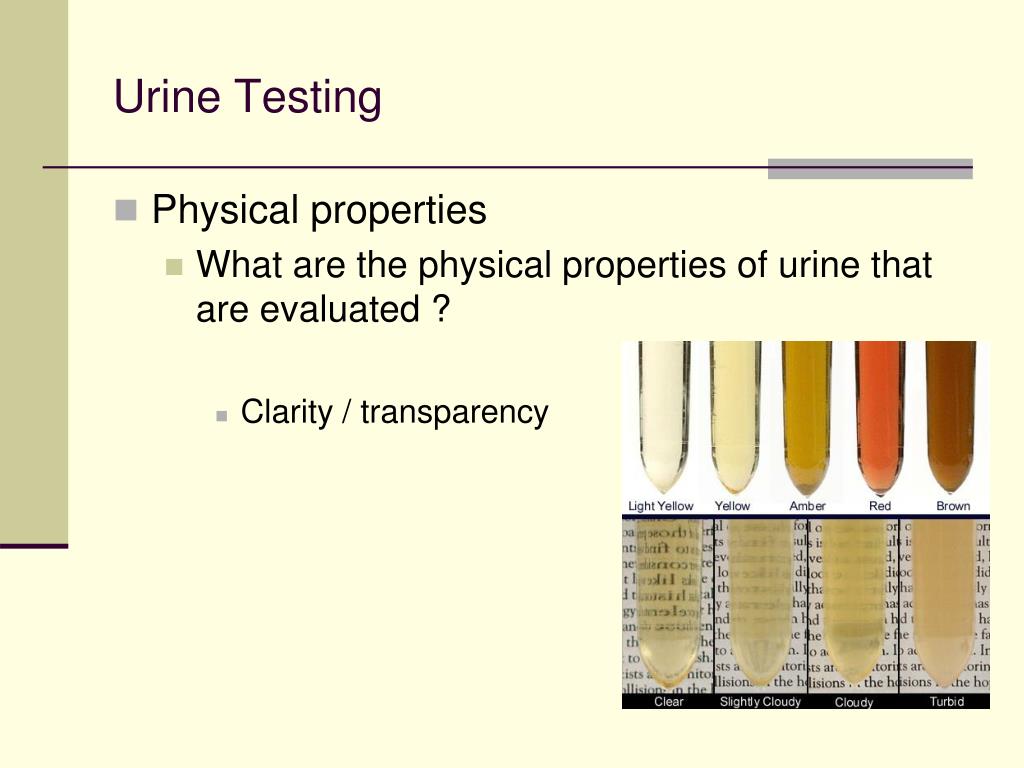 Test properties. Urine Analysis. Composition of urine. Normal urine Analysis. General urine Analysis.