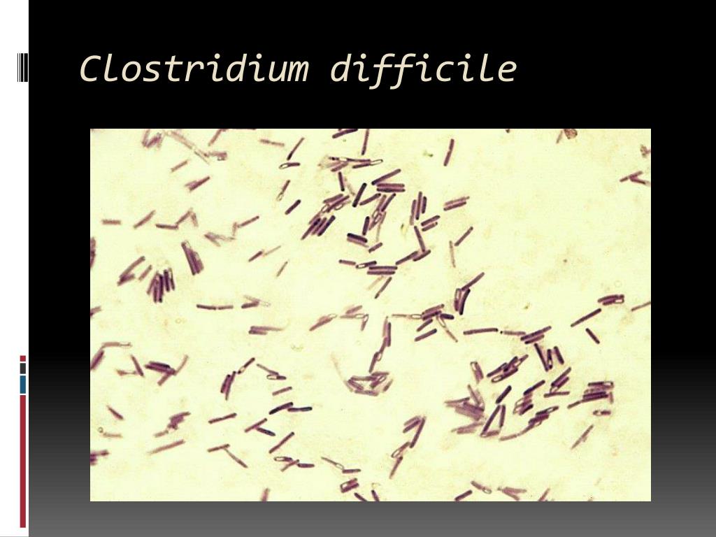 Клостридиум диффициле. Clostridium difficile микробиология. Морфология клостридиум диффициле. Клостридия диффициле Clostridium. Клостридии диффициле мазок.