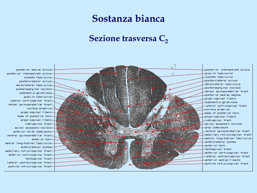 Ipodensità Della Sostanza Bianca Periventricolare PPT - Sostanza bianca Sezioni trasverse C 6 , T x , L 2 , S 2