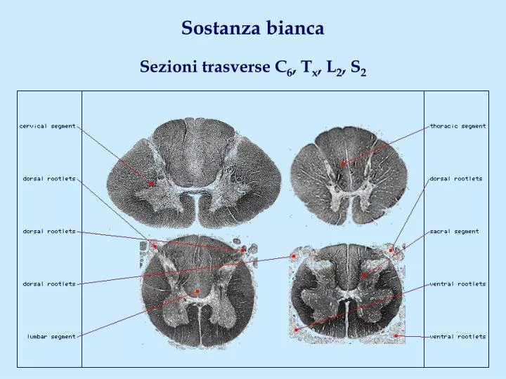 Cosa Significa Ipodensità Della Sostanza Bianca Periventricolare PPT - Sostanza bianca Sezioni trasverse C 6 , T x , L 2 , S 2