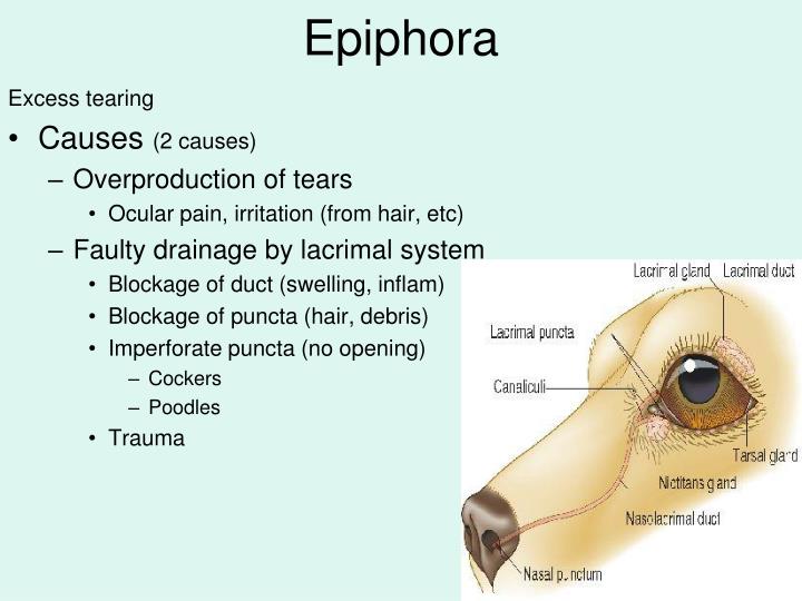 PPT Ophthalmic Diseases PowerPoint Presentation ID 998440