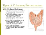 PPT - Bowel Diversion: Ostomies PowerPoint Presentation - ID:998577
